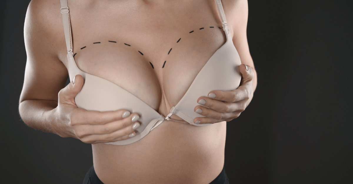 Do Breast Implants Feel Natural to Touch? RG Aesthetics